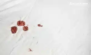 Kiểm tra và xác định vết máu trên nệm trước khi tiến hành vệ sinh