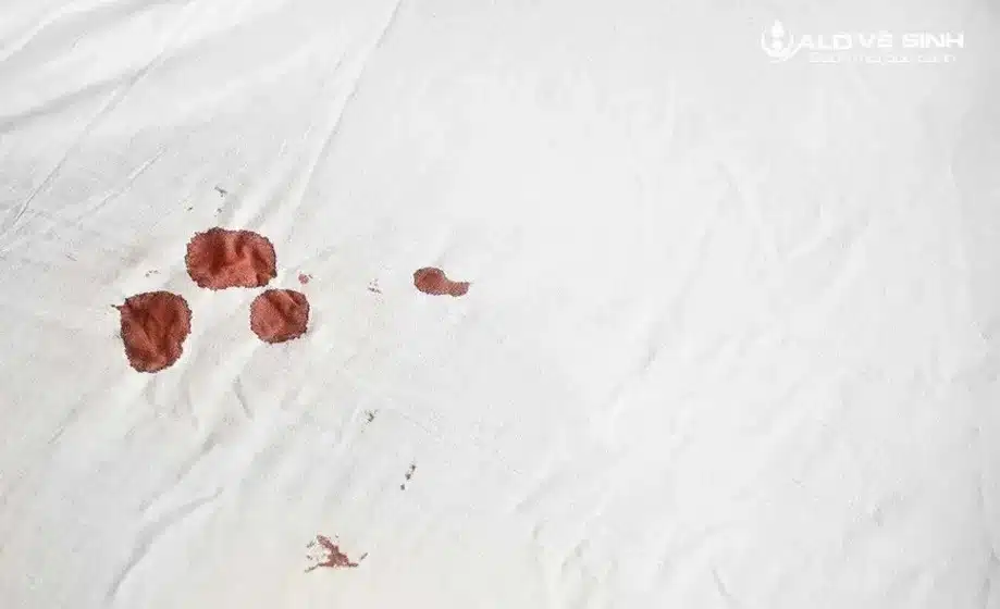 Kiểm tra và xác định vết máu trên nệm trước khi tiến hành vệ sinh